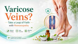 Varicose Veins? Take a Leap of Faith with Homeopathy